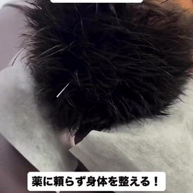 頭痛改善施術！ 薬に頼らない体への画像