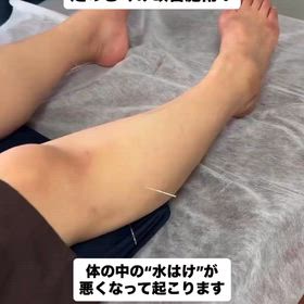 足のむくみは、体の中の“水はけ”が悪くなって起こるのですの画像