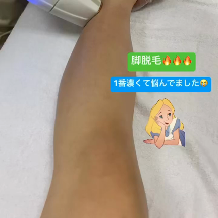 脚脱毛！！の記事動画