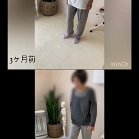 歩くと脚の痺れを感じる方の画像