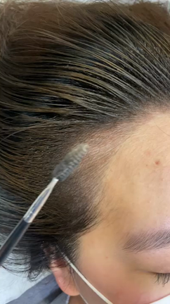 ヘアラインアト－メイクの施術の記事動画