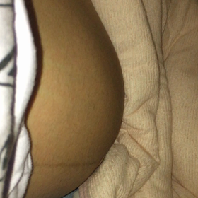 30w6d★出血のその後の画像