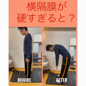 腹圧の必要性の画像