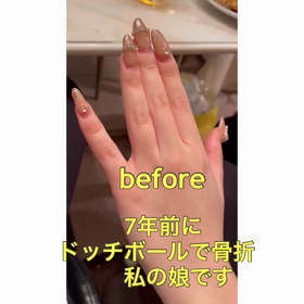 神経系ストレッチ　娘の事例の画像