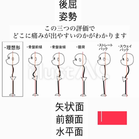 姿勢評価の画像