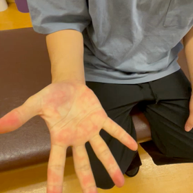 シビレ解決の画像