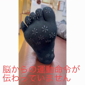 足の指の画像