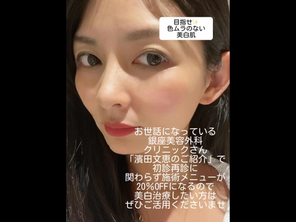 夏の終わりは美白肌を目指すチャンスの記事動画