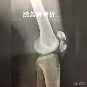 リハビリの軌跡の画像