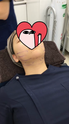 スタッフJちゃんアキュ体験記の記事動画