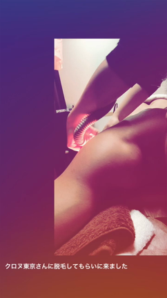 脱毛の記事動画