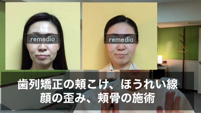 頬こけ ふっくらさせる方法 輪郭美顔のつくりかた 中目黒整体レメディオの戸塚哲春