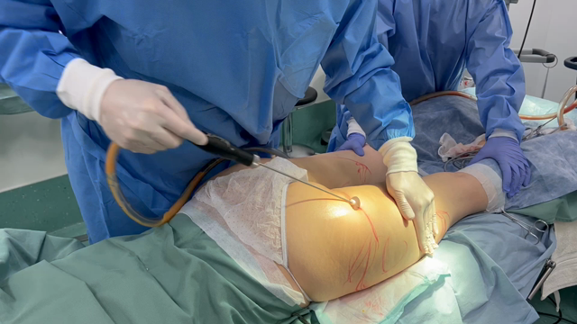 第１１０回日本美容外科学会　脂肪吸引、豊胸の記事動画