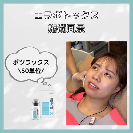 エラボトックスの記事動画