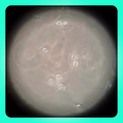 性交後検査・フーナーテスト【動画あり】の記事動画