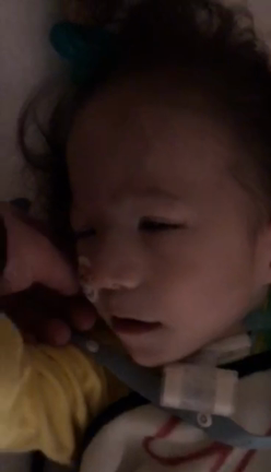 滲出性中耳炎 チュービングの記事動画