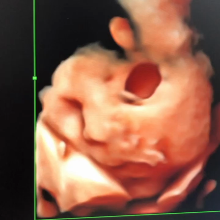 4Dエコーの記事動画