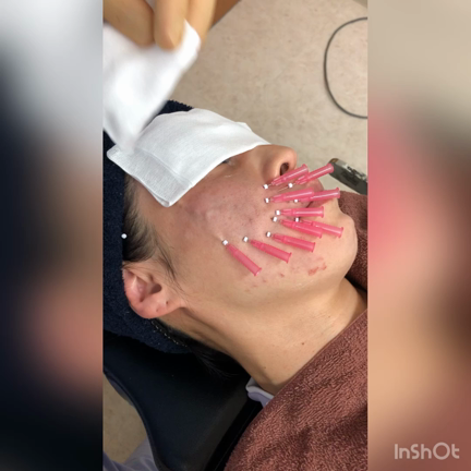 スクリュースレッドリフト③の記事動画