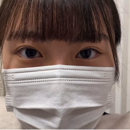 埋没法→全切開のススメ。の記事動画