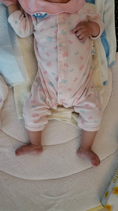 てんかんの前兆 部分発作 Cfc症候群と次女 クリクリお目目ちゃん ꙭ の介護日記