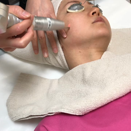 レーザートーニングは肝斑治療に効果があります！の記事動画