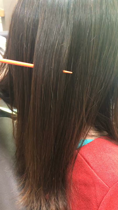 頭皮が臭い原因の記事動画