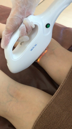 メンズ脱毛セブン 新兵器導入!!の記事動画