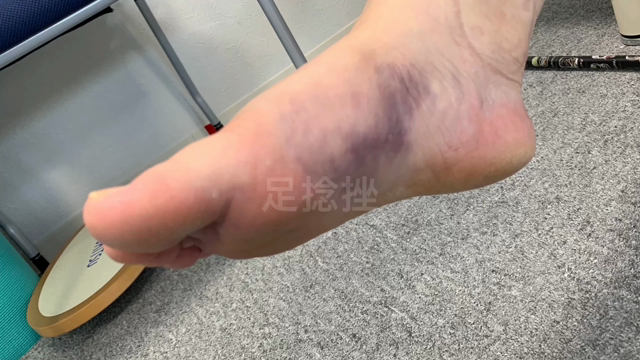 足捻挫をしたけどすぐに歩けるようになる！の記事動画