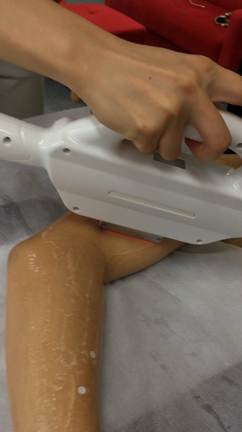 脱毛に行くきっかけの記事動画