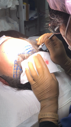 今日の1枚〜プレーシング動画〜の記事動画