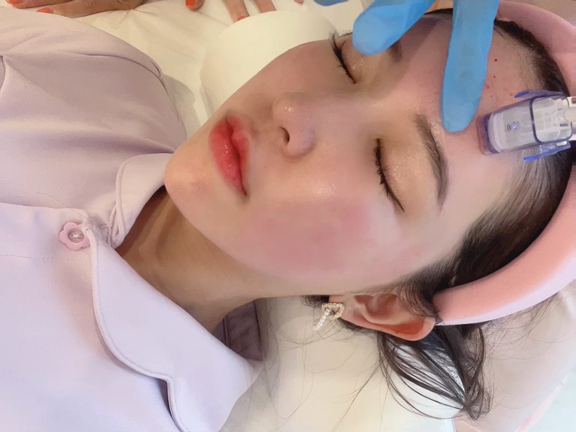 月に一度の肌管理❤️水光注射×トーニングの記事動画