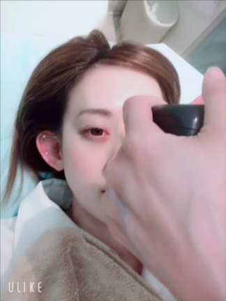 アンテラで肌の内側をチェック☆の記事動画