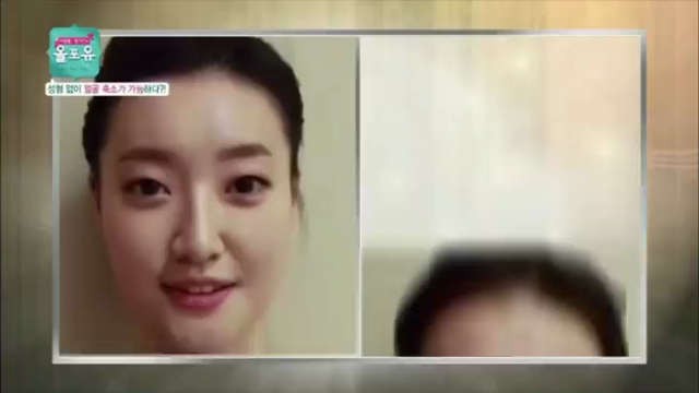 施術後、効果が一目で分かるコルグンセラピー！の記事動画