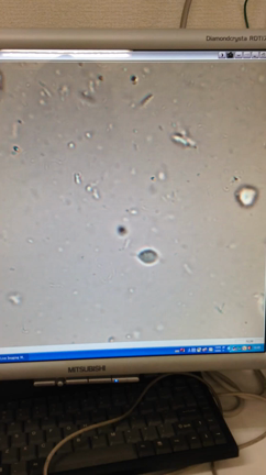 寄生虫だらけですの記事動画