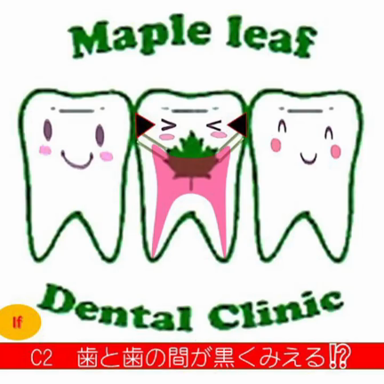 歯と歯の間が黒く見える！の記事動画