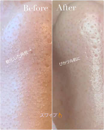 ★毛穴エクストラクションモニター終了しましたの記事動画