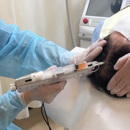 PRP 育毛治療【動画あり】の記事動画