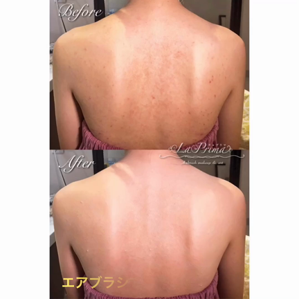 ニキビ跡がぜんぜん目立たず楽しめました ブライダルボディメイク ボディアート La Prima 大阪 東京 神奈川