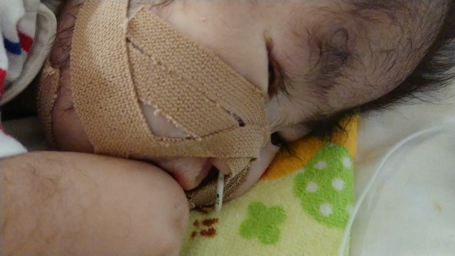 生後817日目・入院18日目   明日の記事動画