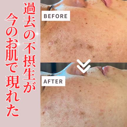4月から光フェイシャルの50歳女性の記事動画
