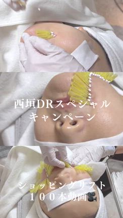 ショッピングリフトで、ポニョ対策！の記事動画