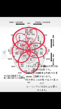 前髪が切れた！醜形恐怖症のヒーリングの結果の記事動画