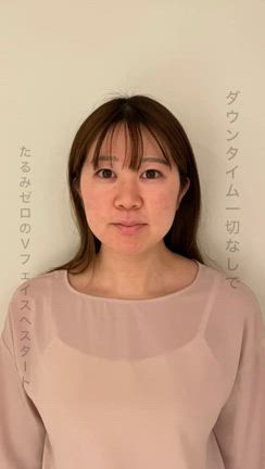 浜松市小顔　ビフォーアフター『顔がひと回り小さくなる小顔矯正』の記事動画