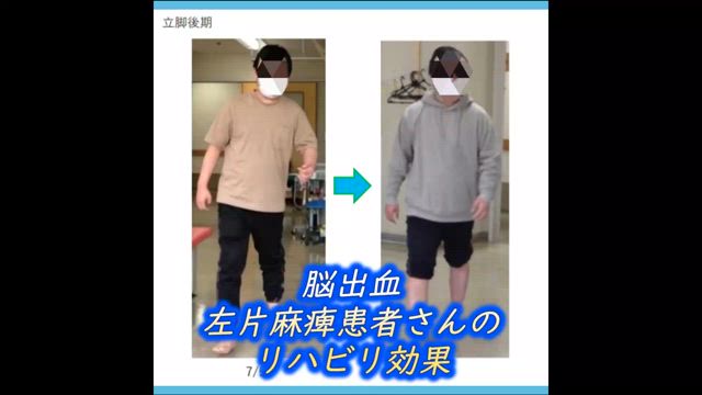 三重県で脳梗塞の自費リハビリするならの記事動画