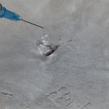 リブログ ”大正解！手の甲アンチエイジング、ヒアルロン酸の経過”の記事動画