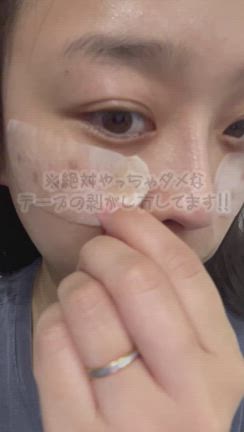 PIH(炎症後色素沈着）を爆速で治したいの記事動画