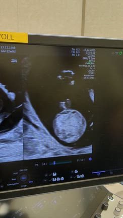 Mount Sinai Hospitalへ行ってきたの記事動画