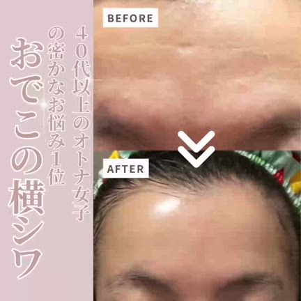 ❤エステ先進国イギリス設計❣敏感肌やお肌の弱い方でも安心安全♪❤最先端脱毛器 フラゲレビュー】＆ROSY（アンドロージー）2023年10月号《特別