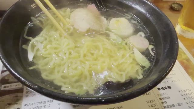 顎なし、口ゴボ、いびきを同時に伴う下顎矮小症 してはならない治療・手術➀　-抜歯矯正の記事動画