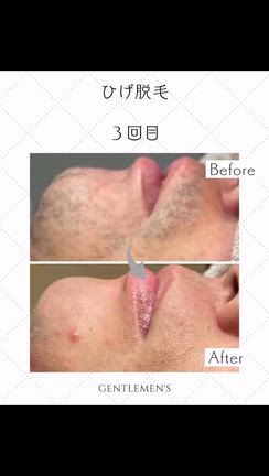 たまってしまった写真vol.2の記事動画